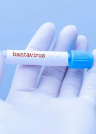 Edukasi hantavirus kepada warga binaan