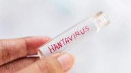 Hantavirus